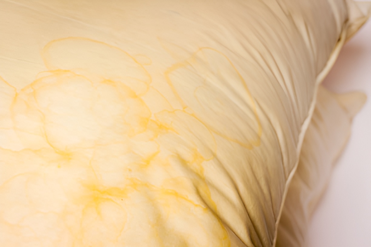 close-up of yellow stains on a pillow